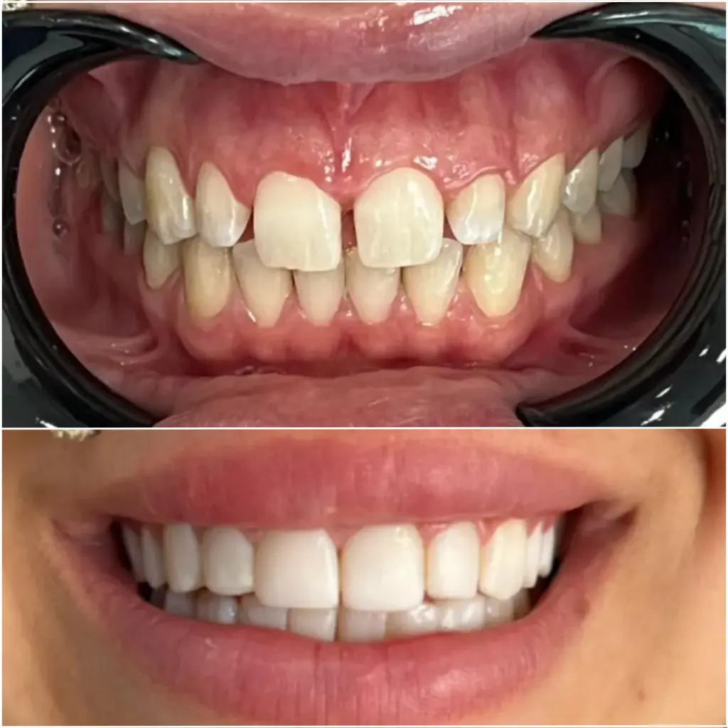 Case 3 result